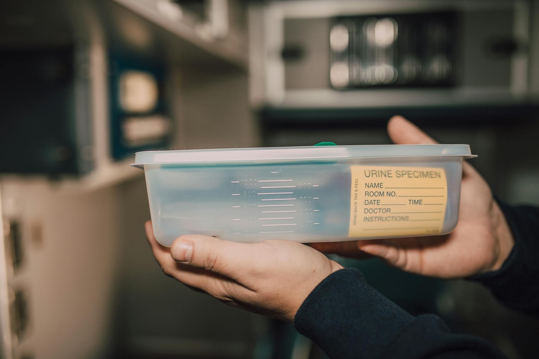 Dłonie w rękawiczkach trzymają pojemnik z moczem w laboratorium