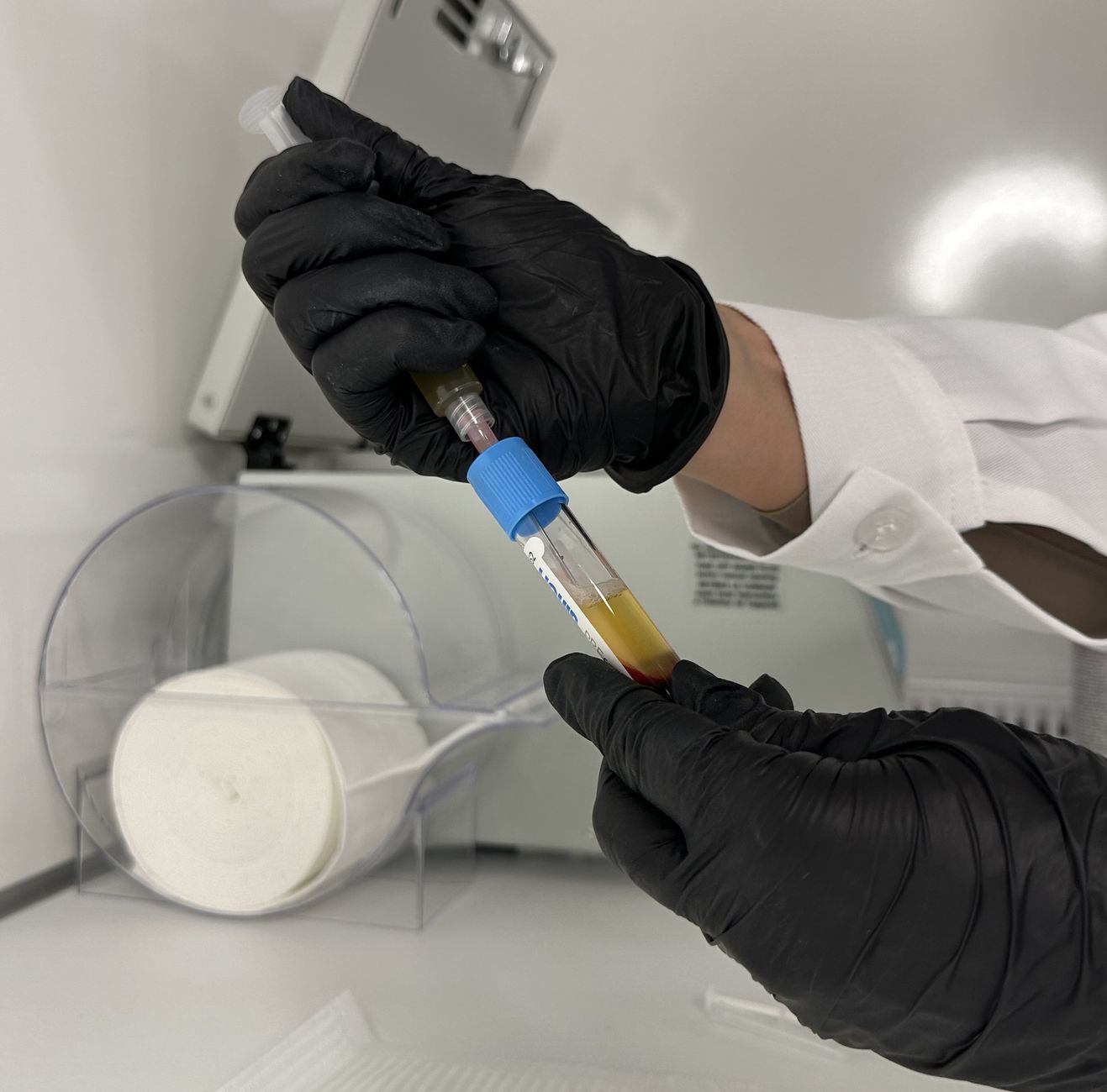 Laborant napełnia probówkę krwią strzykawką podczas badania laboratoryjnego