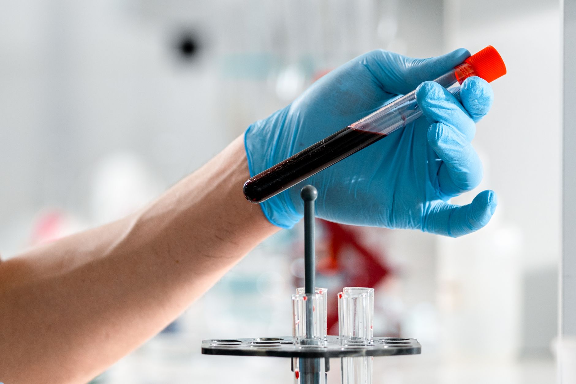 Ręka w rękawiczce trzyma probówkę z krwią w laboratorium