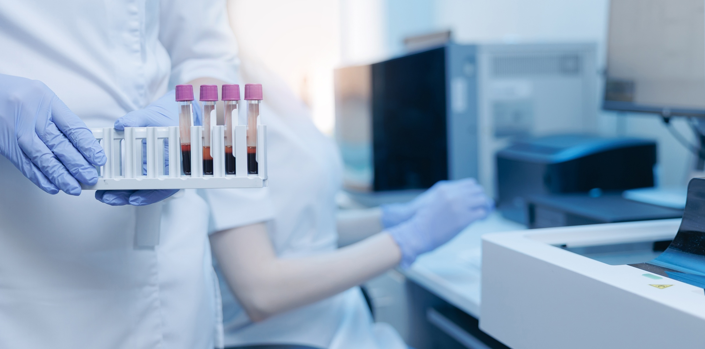 Probówki z surowicą krwi przygotowane do oznaczenia kreatyniny i eGFR w laboratorium