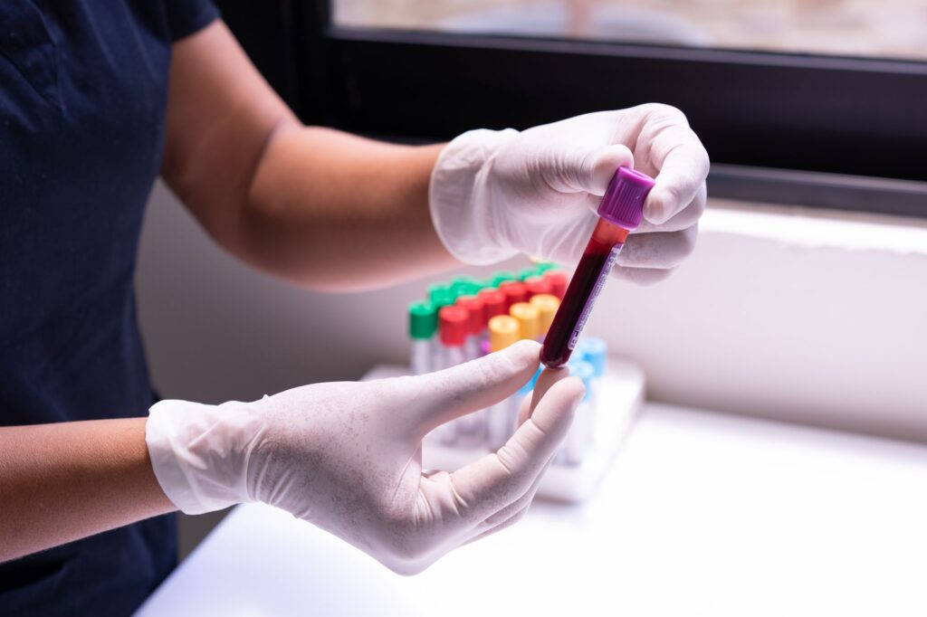 Dłonie w rękawiczkach trzymające próbkę krwi w laboratorium